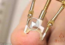 3 Ways to Prevent of Ingrown Toenails
